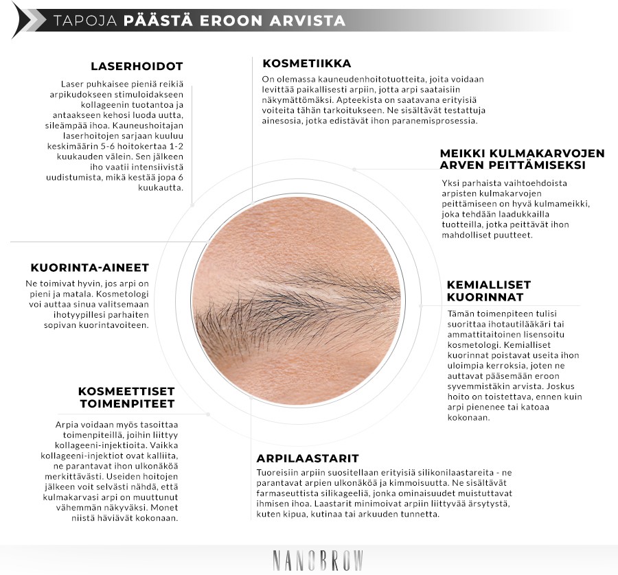 TAPOJA PÄÄSTÄ EROON ARVISTA